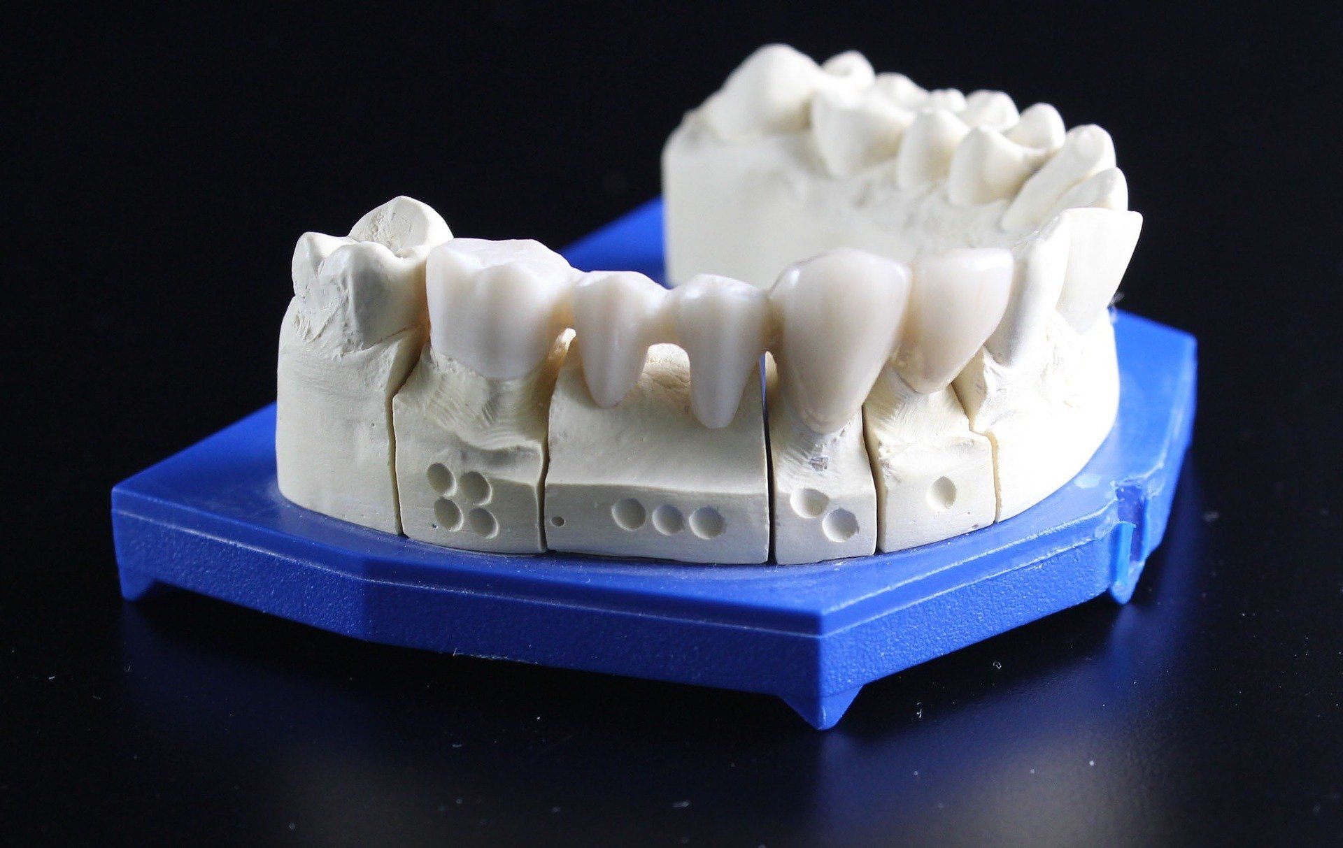 Dental Materialien in der digitalen Zahntechnik