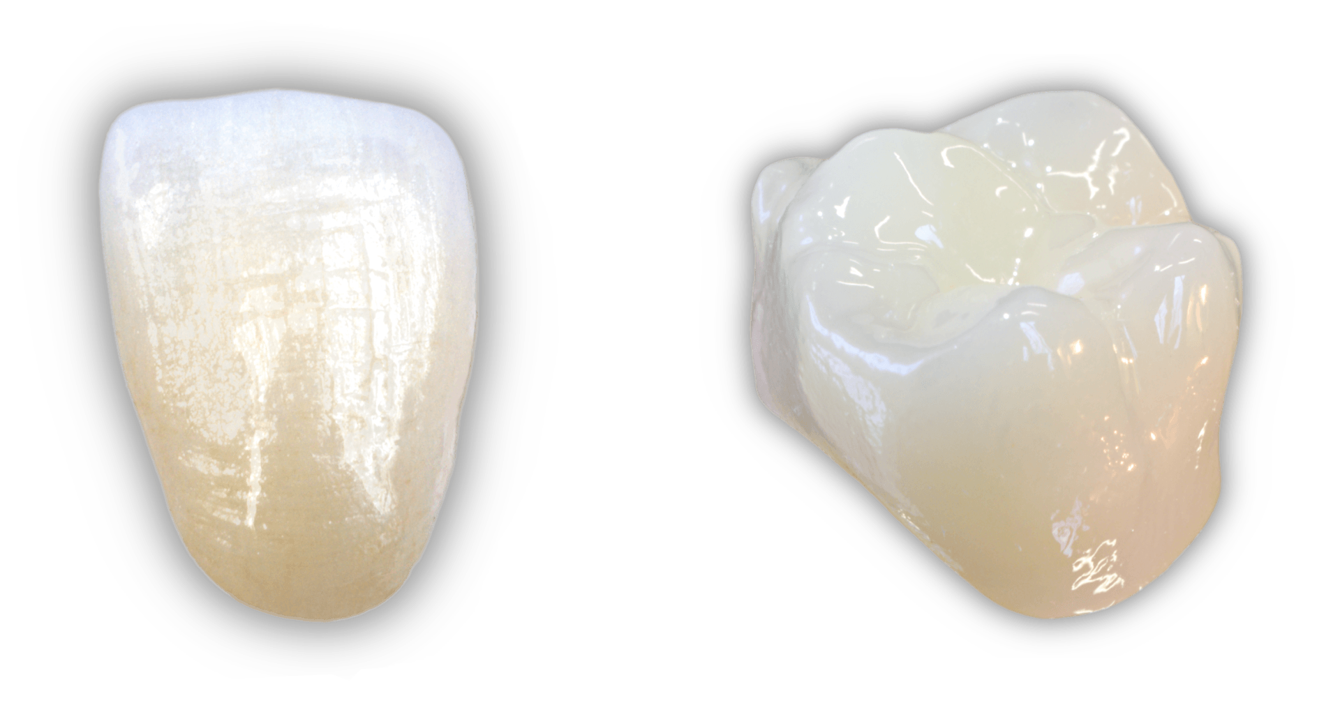 Festsitzender keramischer Zahnersatz aus Zirkonoxid